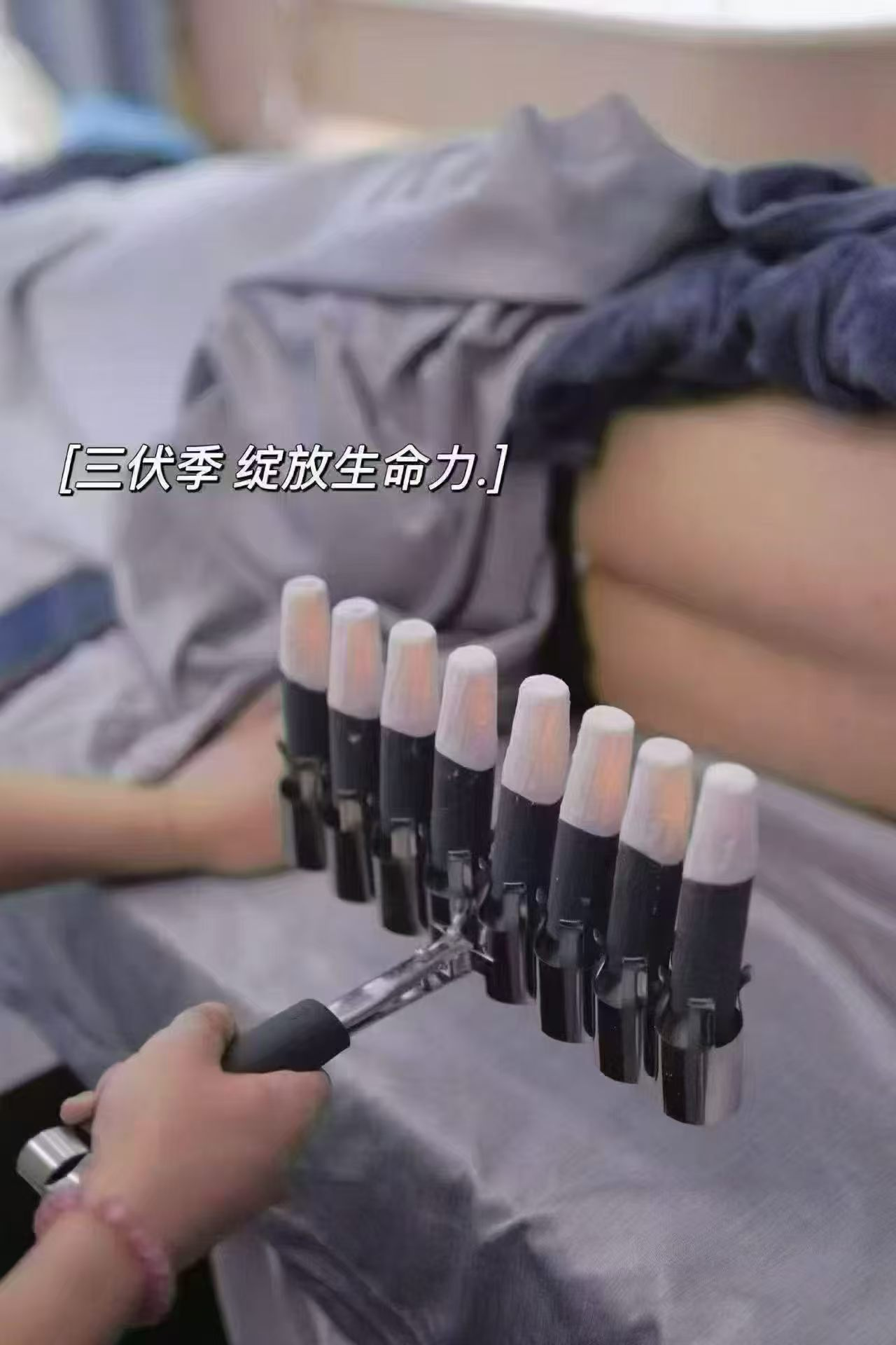 2026年火龙灸哪家效果好 艾福蓓专业服务广受好评